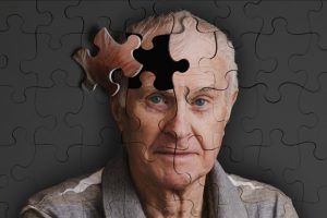 Развитие болезни Альцгеймера при курении
