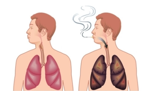 Вред курения для легких