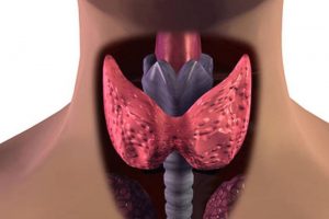 Появление кома в горле при заболеваниях щитовидной железы