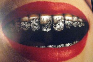 Вред курения для зубов