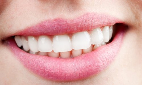Возможность очищения зубов от никотина