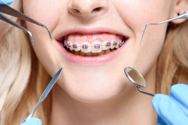 Лечение зубов, протезирование и исправление прикуса в Брекет Систем
